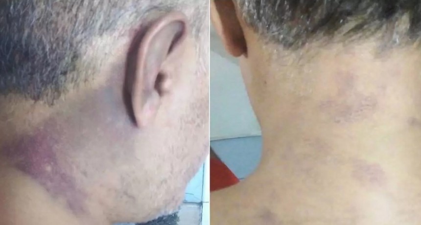 Brutal ataque a un comerciante: intentaron ahorcarlo y le rompieron el tend&oacute;n de Aquiles