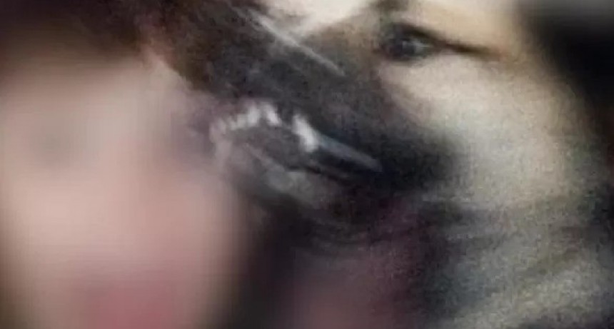 UN NI&Ntilde;O FUE ATACADO POR UN PERRO PITBULL EN CERCANIAS DE EL EX COLEGIO NACIONAL