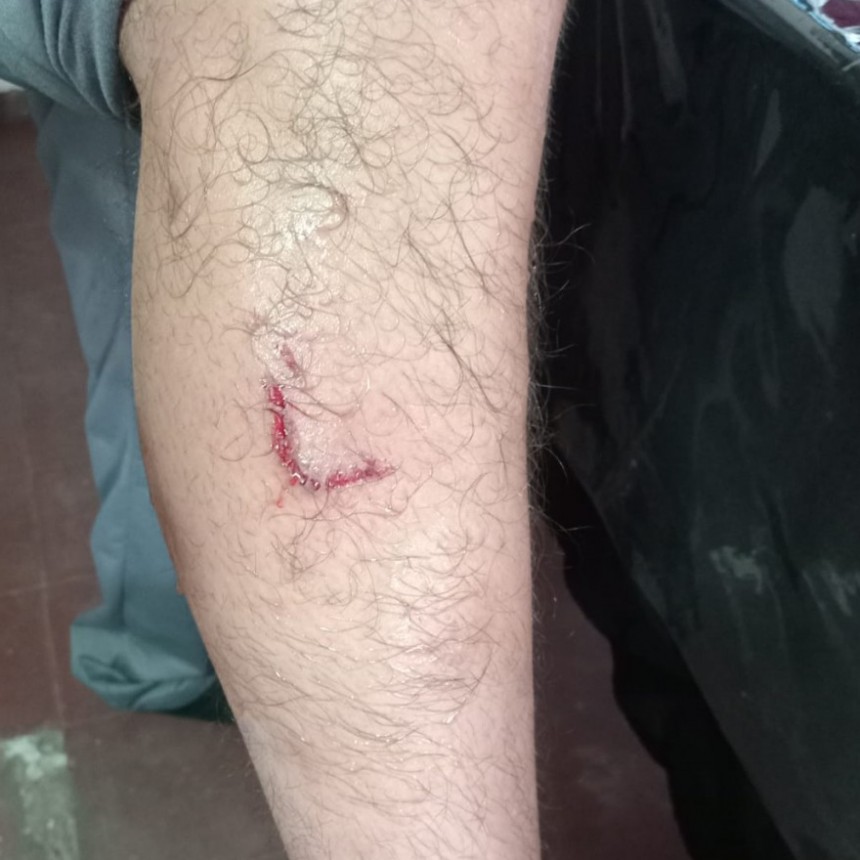 Nuevo Ataque de perro en el Parque San Martin