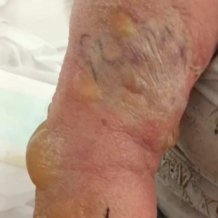 Taller de Prevencion y cuidados por presencia de Ara&ntilde;as,Alacranes y Viboras