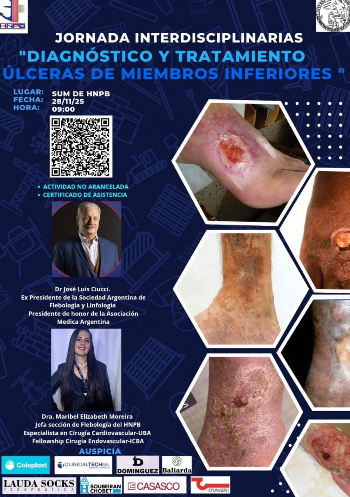 Jornada interdisciplinaria en el HNPB sobre diagn&oacute;stico y tratamiento de &uacute;lceras en miembros inferiores